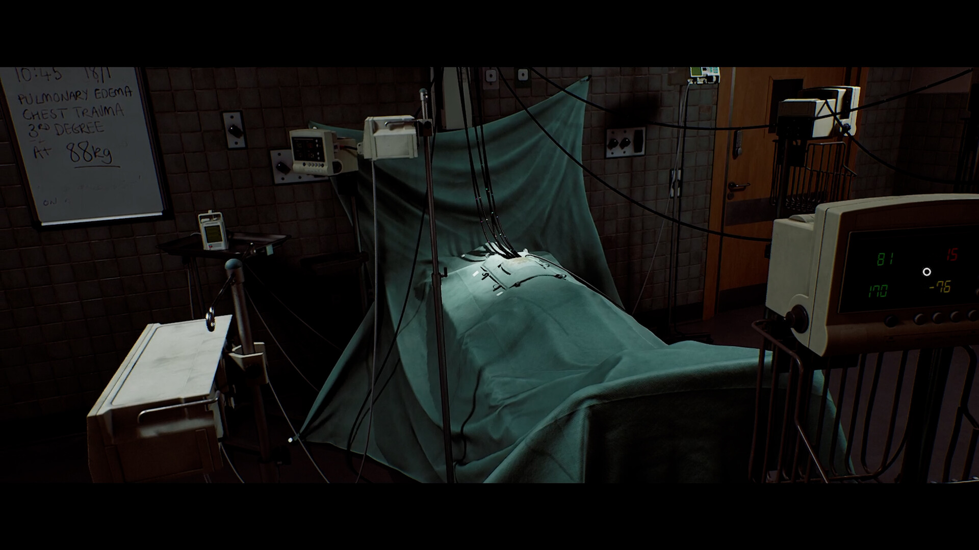 A clinical room with a draped bed, monitors and a handwritten whiteboard